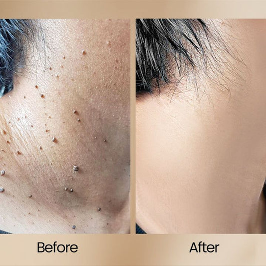Tag Recede - Bee Venom Repair Spray (Original)