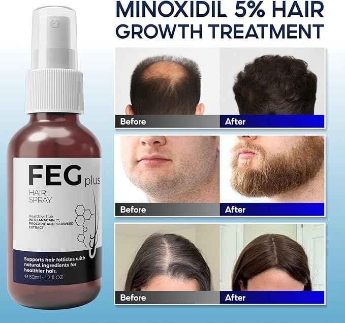 FEG Hair Growth Spray PLUS – Advanced Hair Regrowth & Anti-Hair Fall Treatment (Orginal)